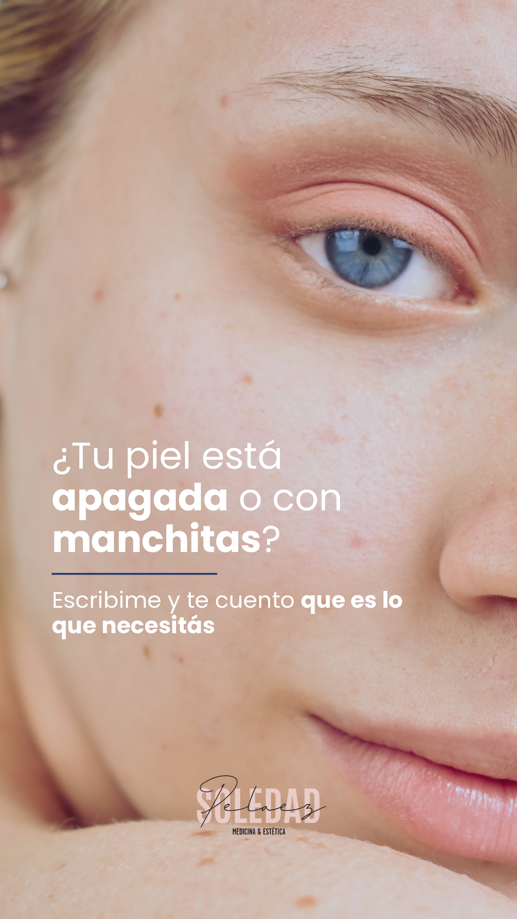 ¿Tu piel está apagada o con manchitas?