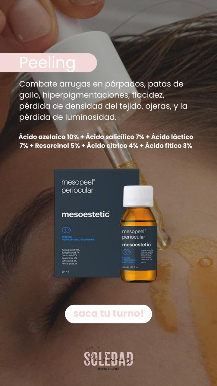 Peeling periocular con mesopeel, indicaciones y composición