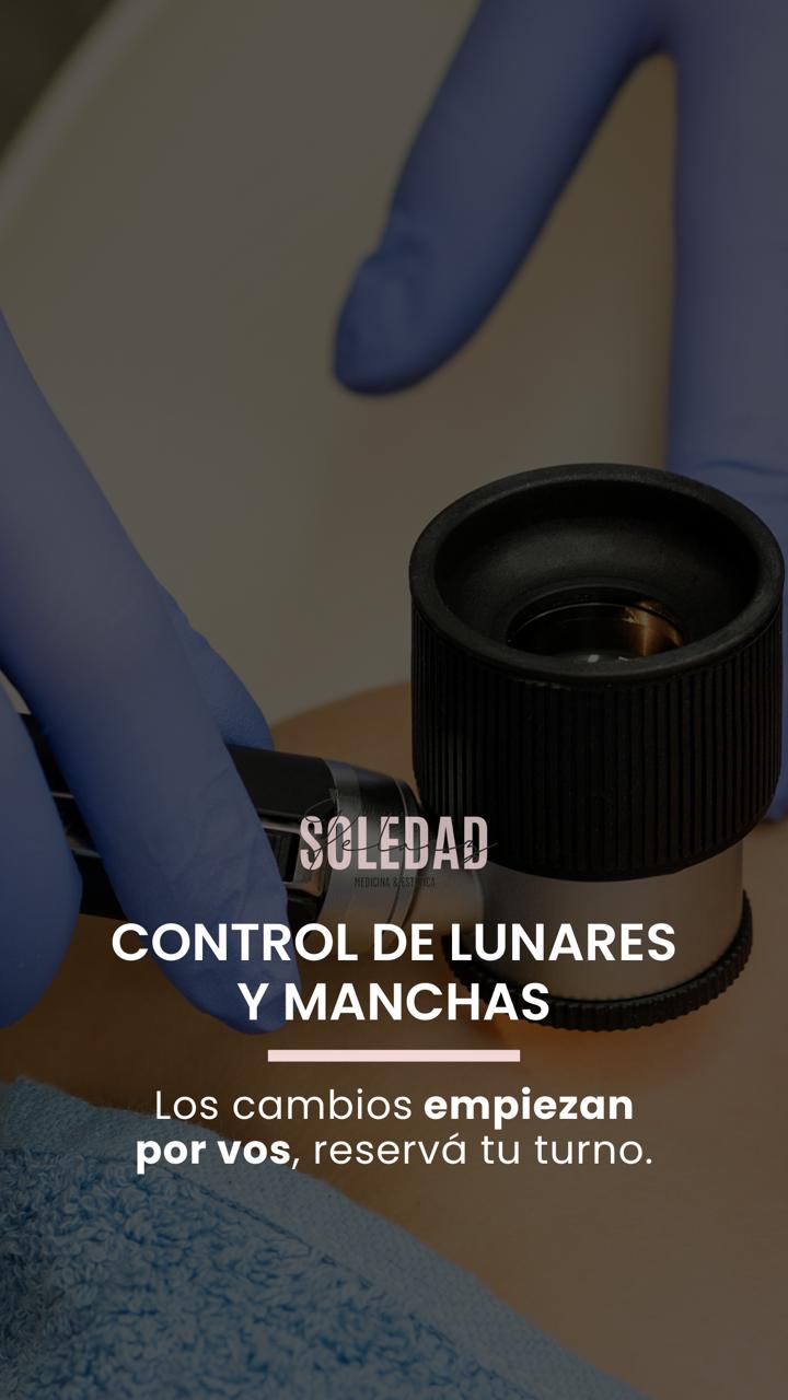 Control de lunares y manchas, reservá tu turno