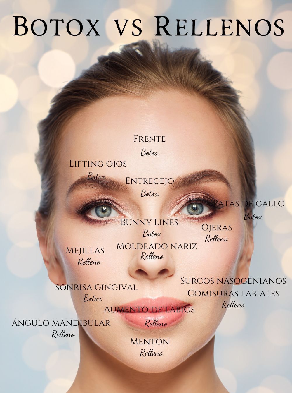 Botox vs rellenos, zonas del rostro