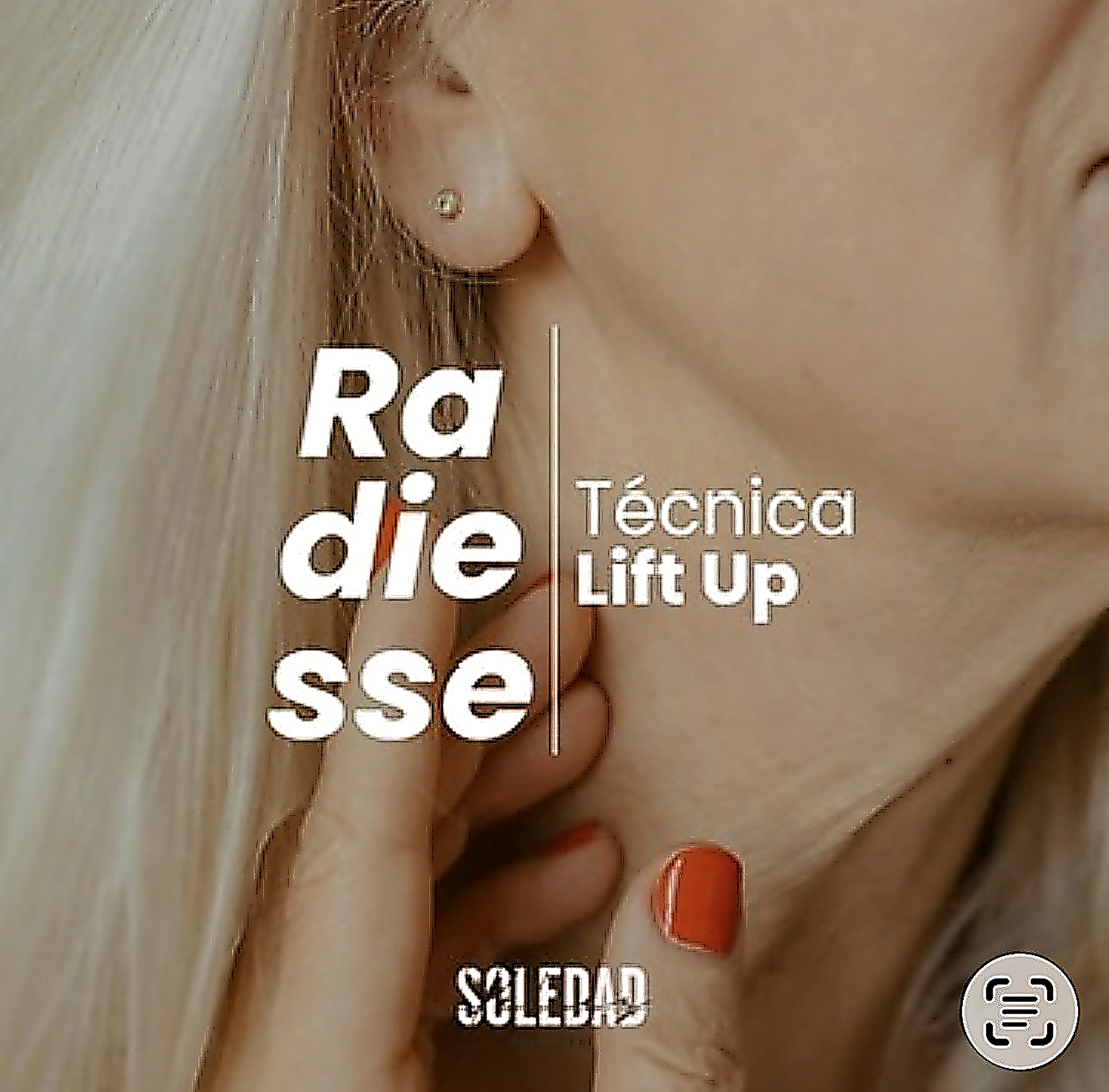 Radiesse técnica Lift Up