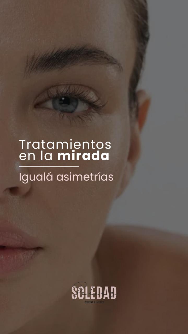 Tratamientos en la mirada, igualá asimetrías