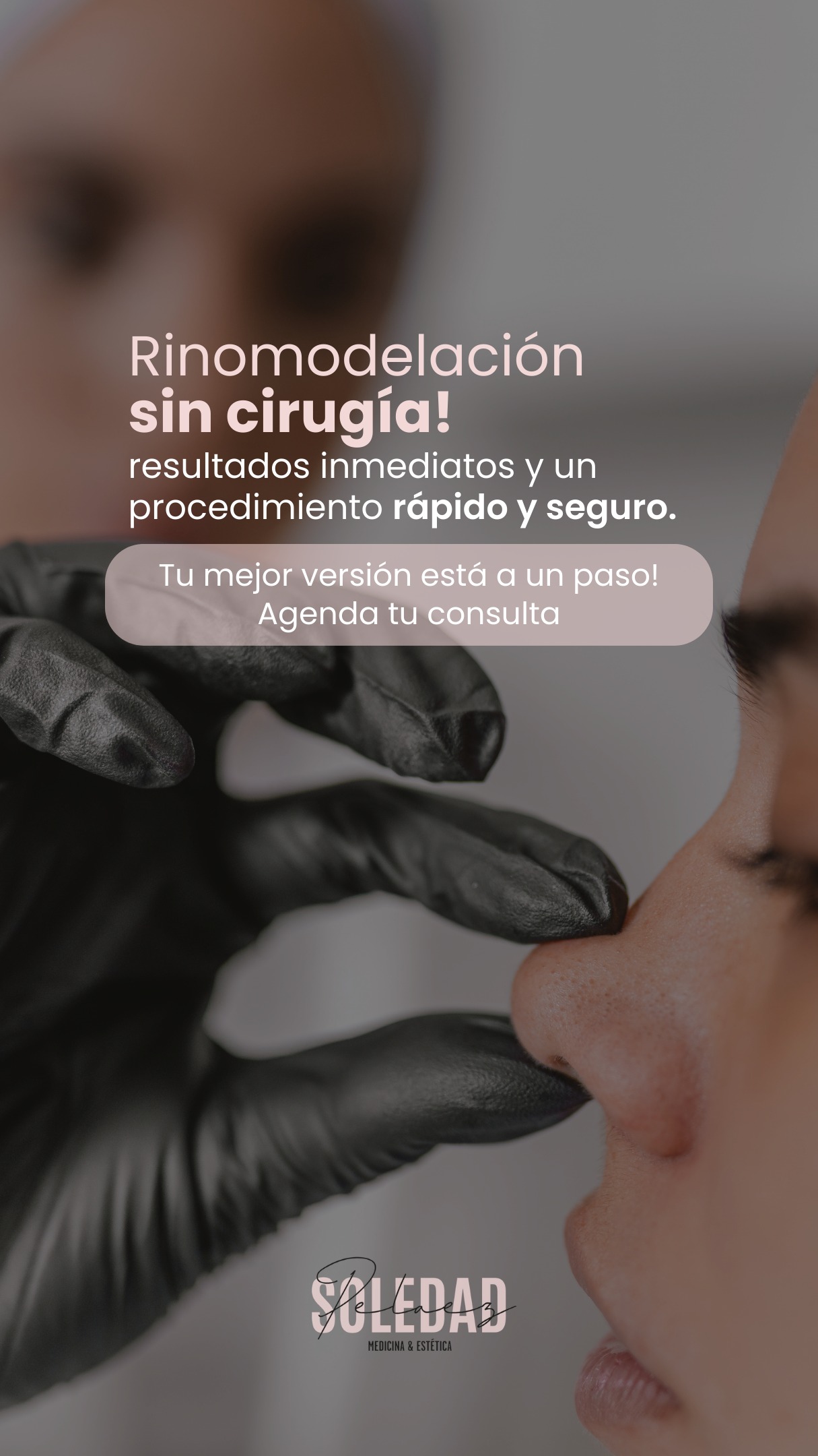 Rinomodelación sin cirugía, resultados inmediatos